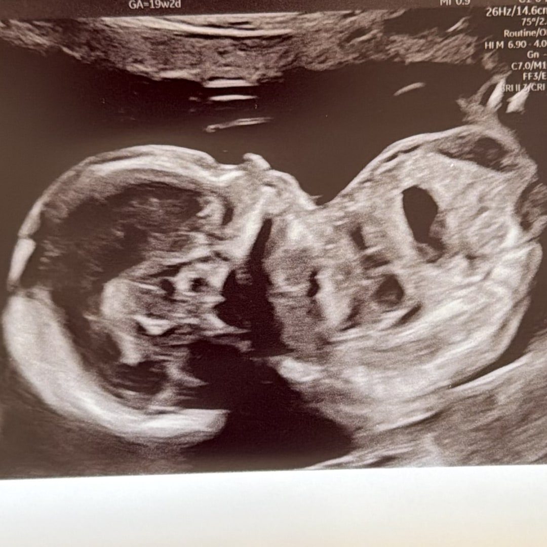 Photo shared by Amanda for their Babylist baby registry.