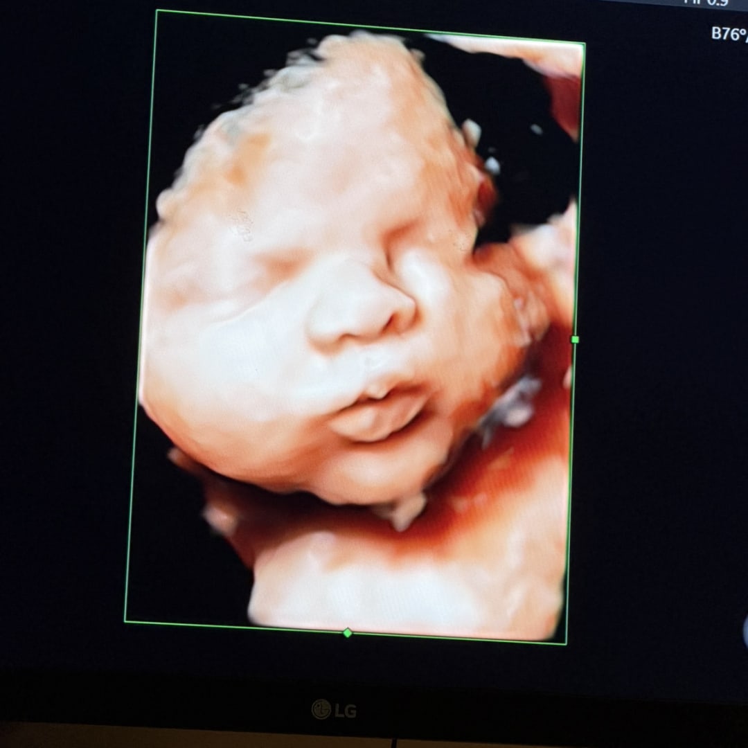 Photo shared by Kimberly for their Babylist baby registry.