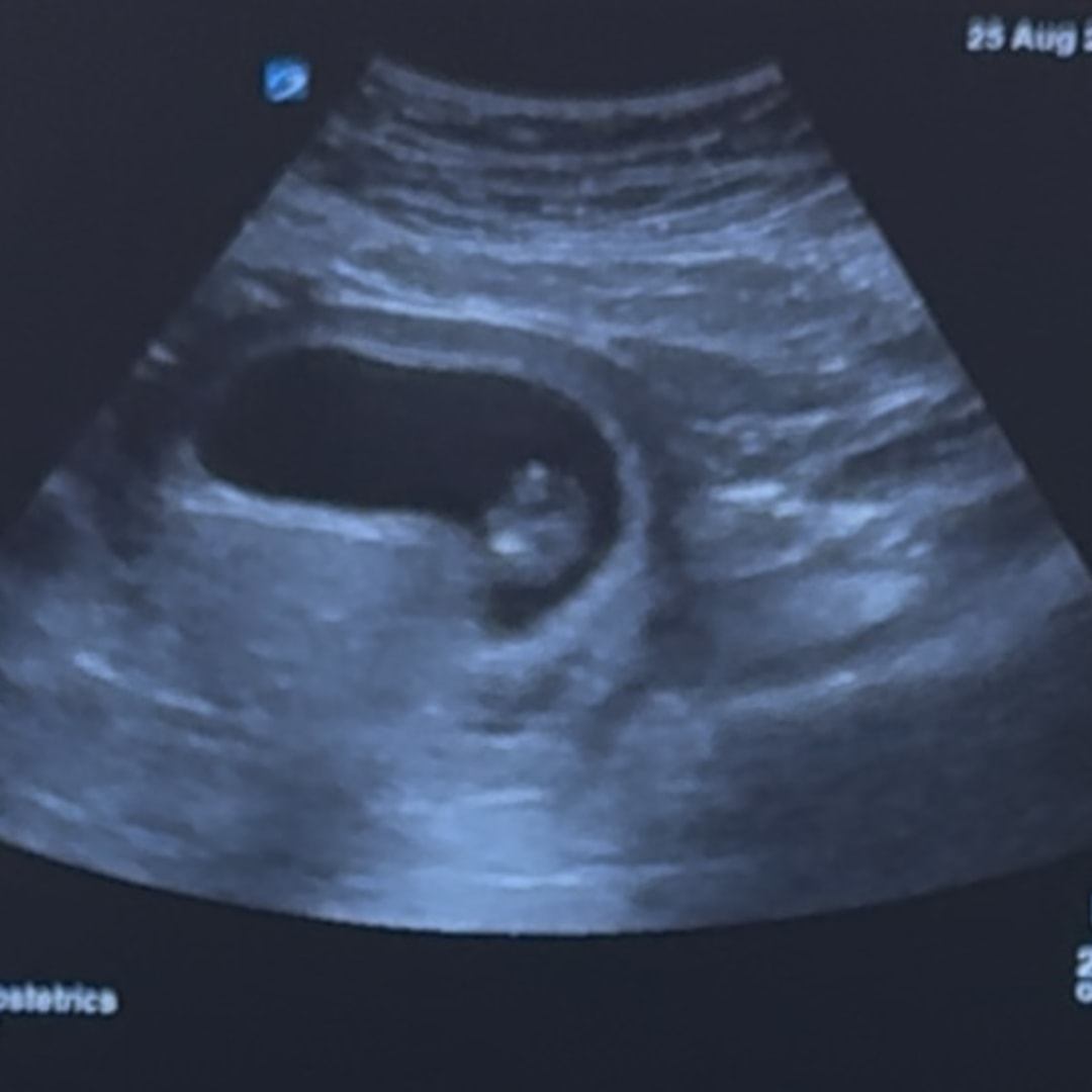 Photo shared by Aylin for their Babylist baby registry.