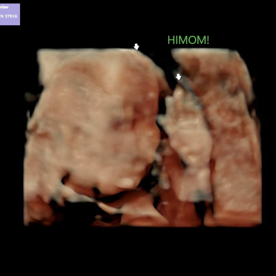 Photo shared by Alley for their Babylist baby registry.