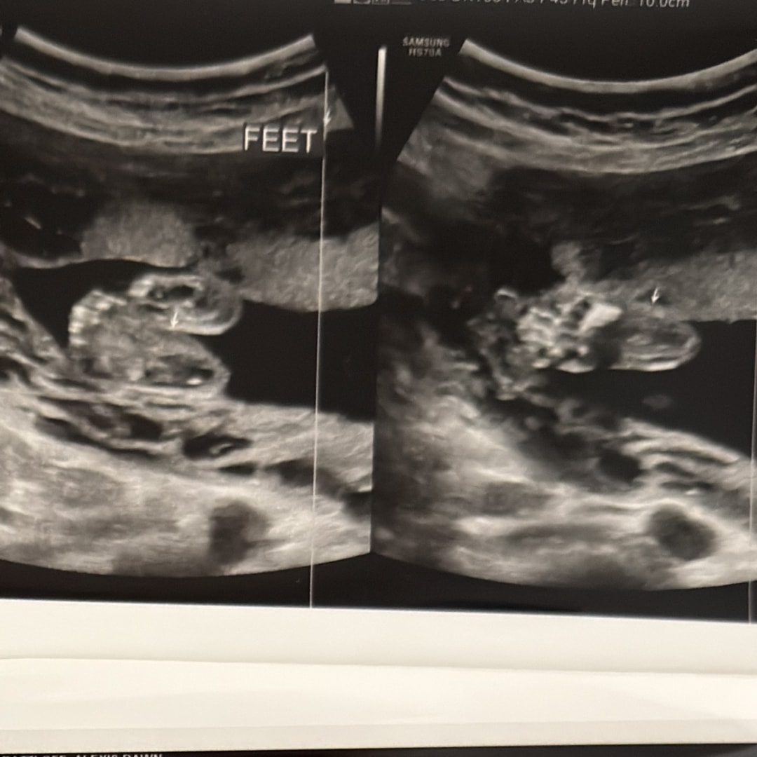 Photo shared by Alexis for their Babylist baby registry.
