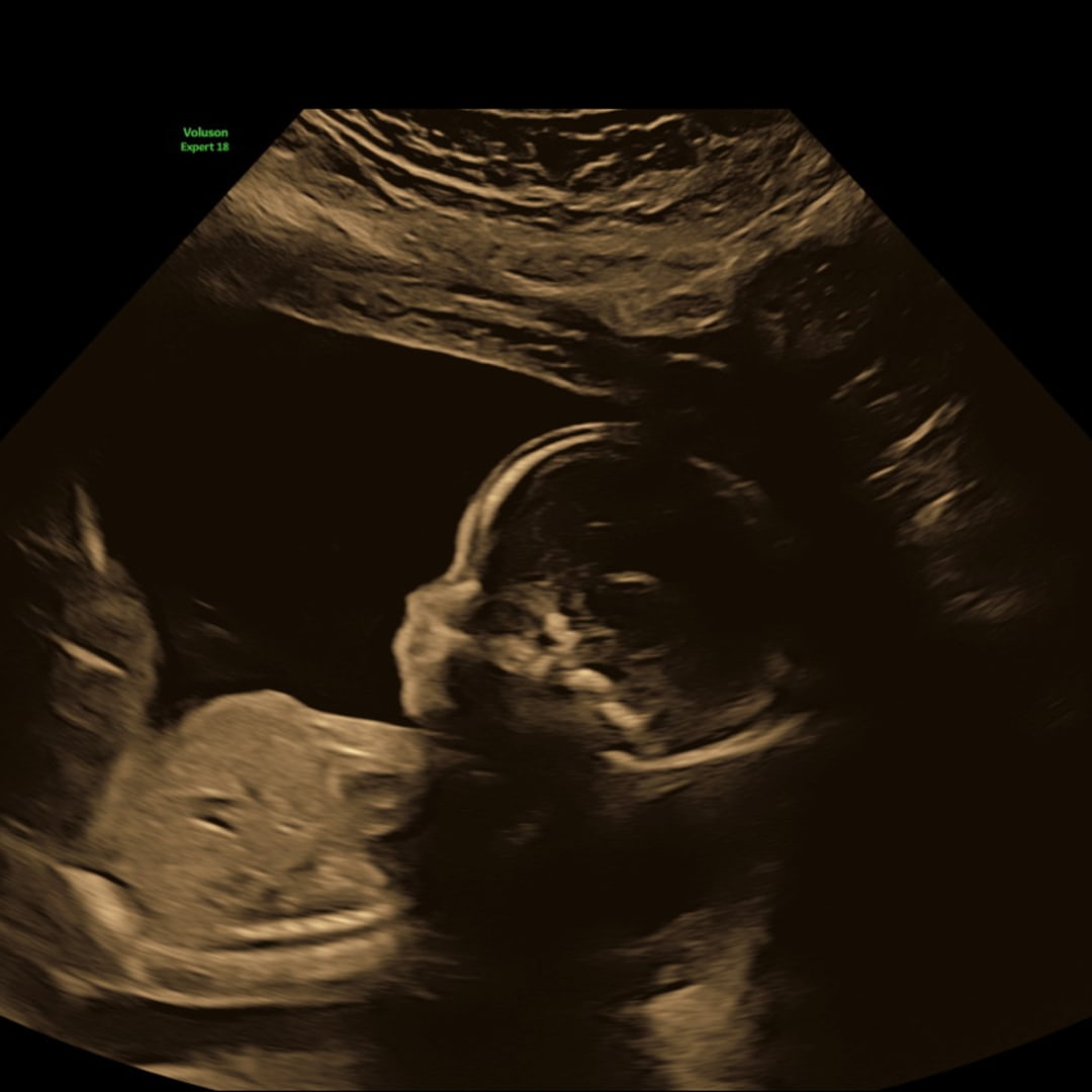 Photo shared by Amanda for their Babylist baby registry.