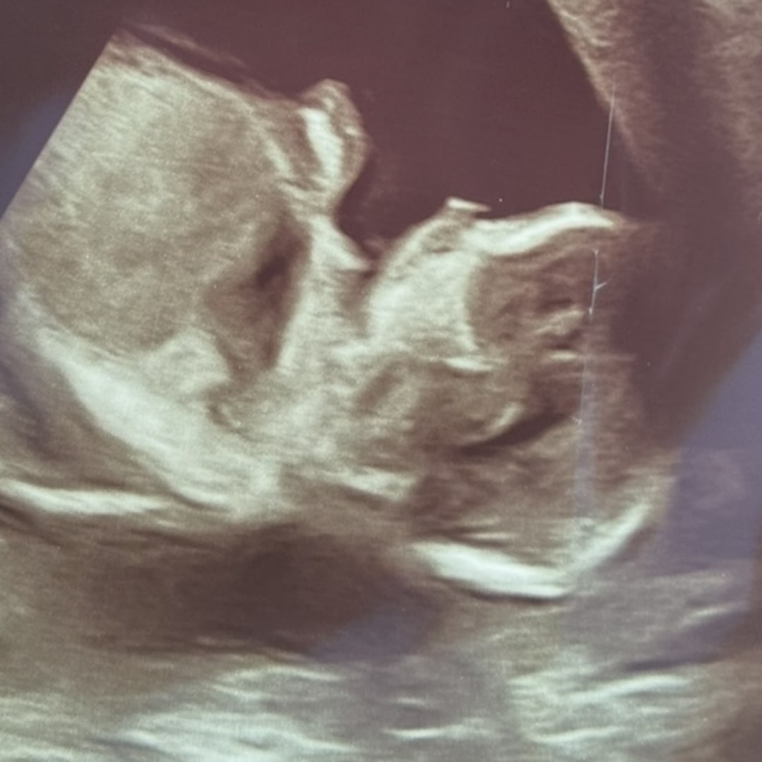 Photo shared by Allyson for their Babylist baby registry.