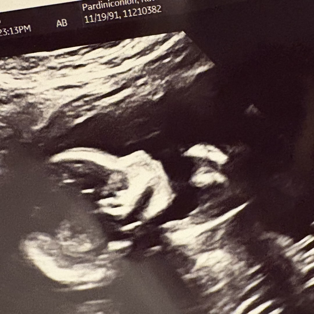 Photo shared by Kate for their Babylist baby registry.