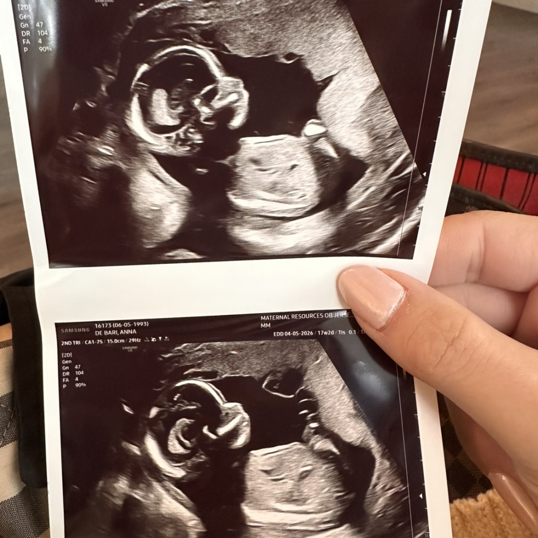 Photo shared by Annamaria for their Babylist baby registry.