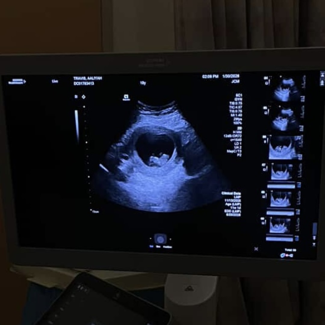 Photo shared by Aaliyah for their Babylist baby registry.