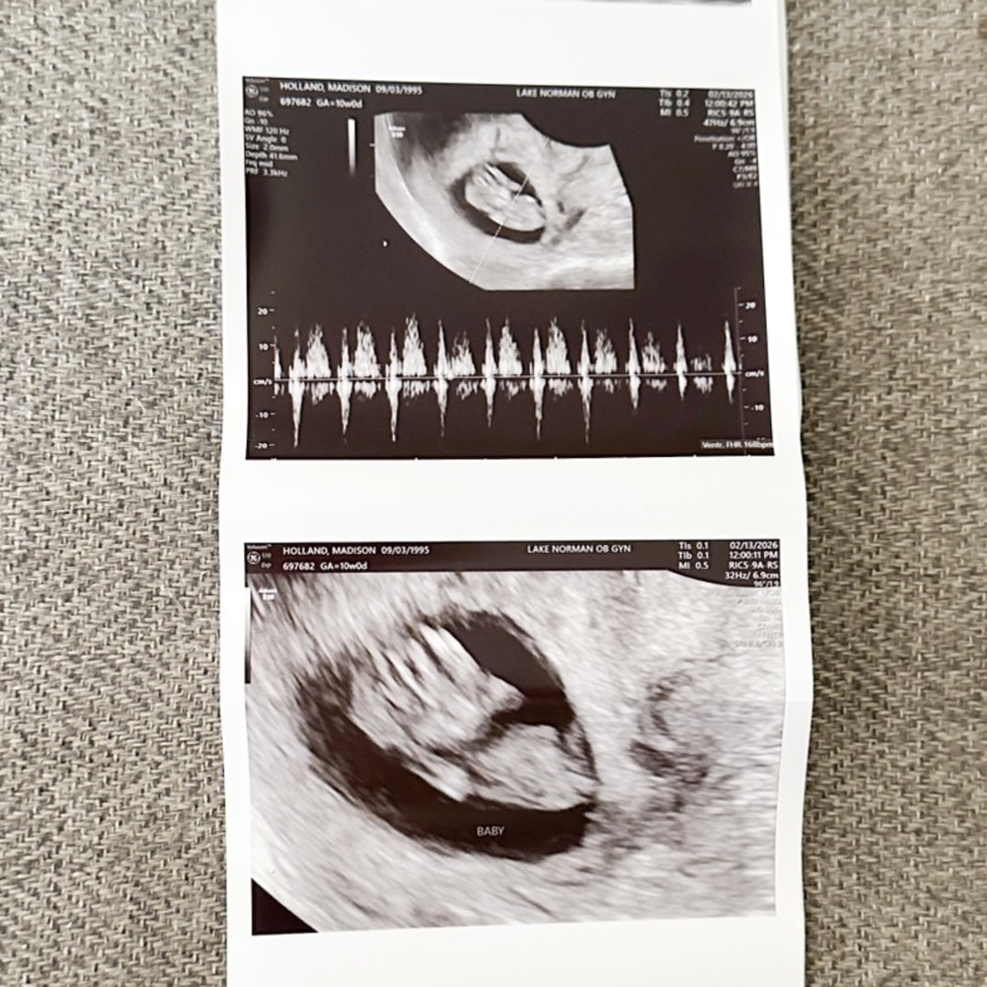Photo shared by Madison for their Babylist baby registry.