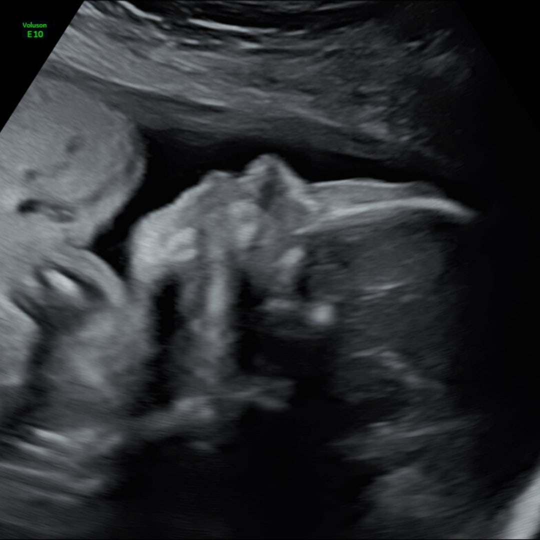 Photo shared by Ashley for their Babylist baby registry.