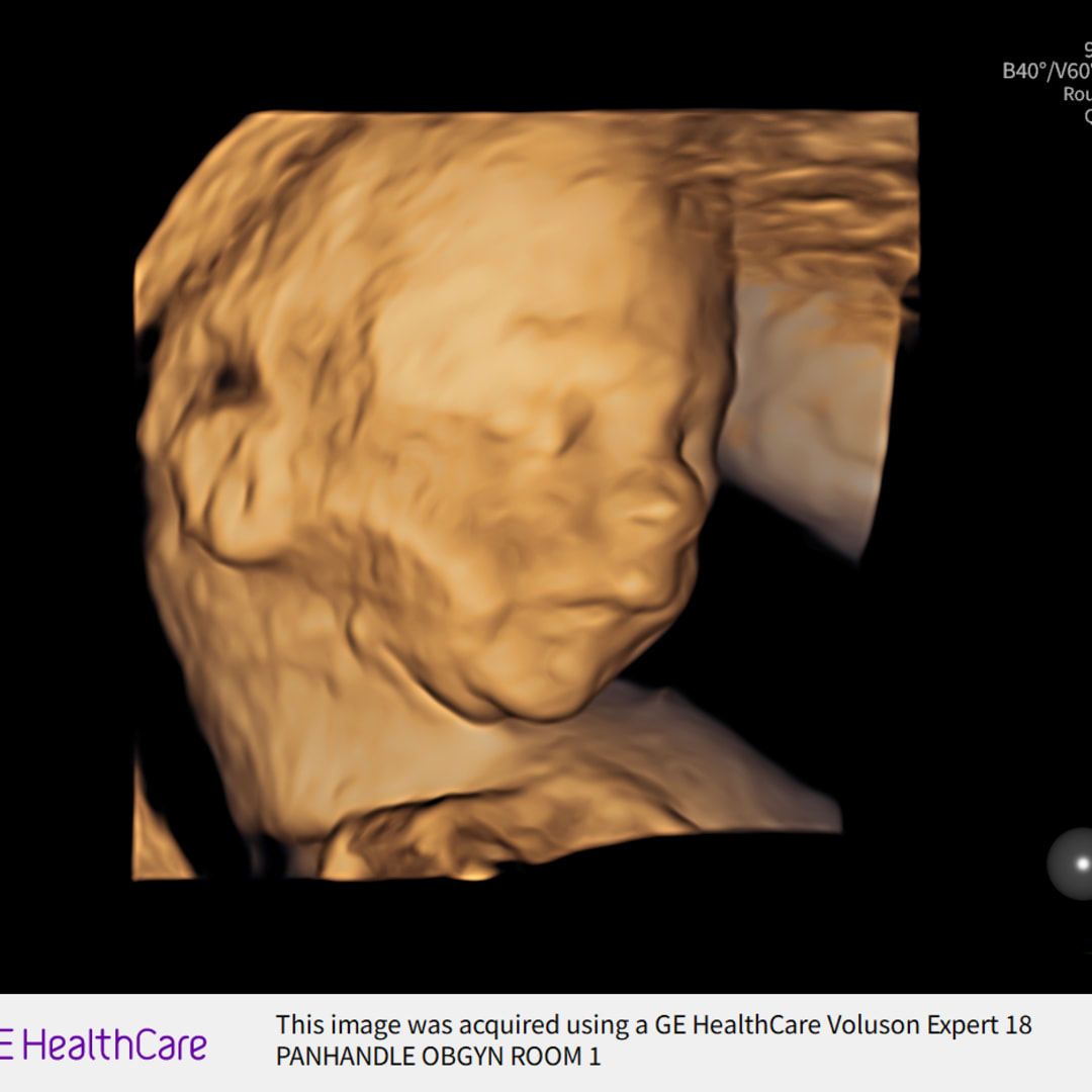 Photo shared by Denise for their Babylist baby registry.