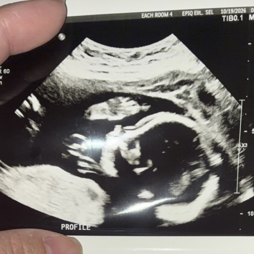 Photo shared by Chloe for their Babylist baby registry.