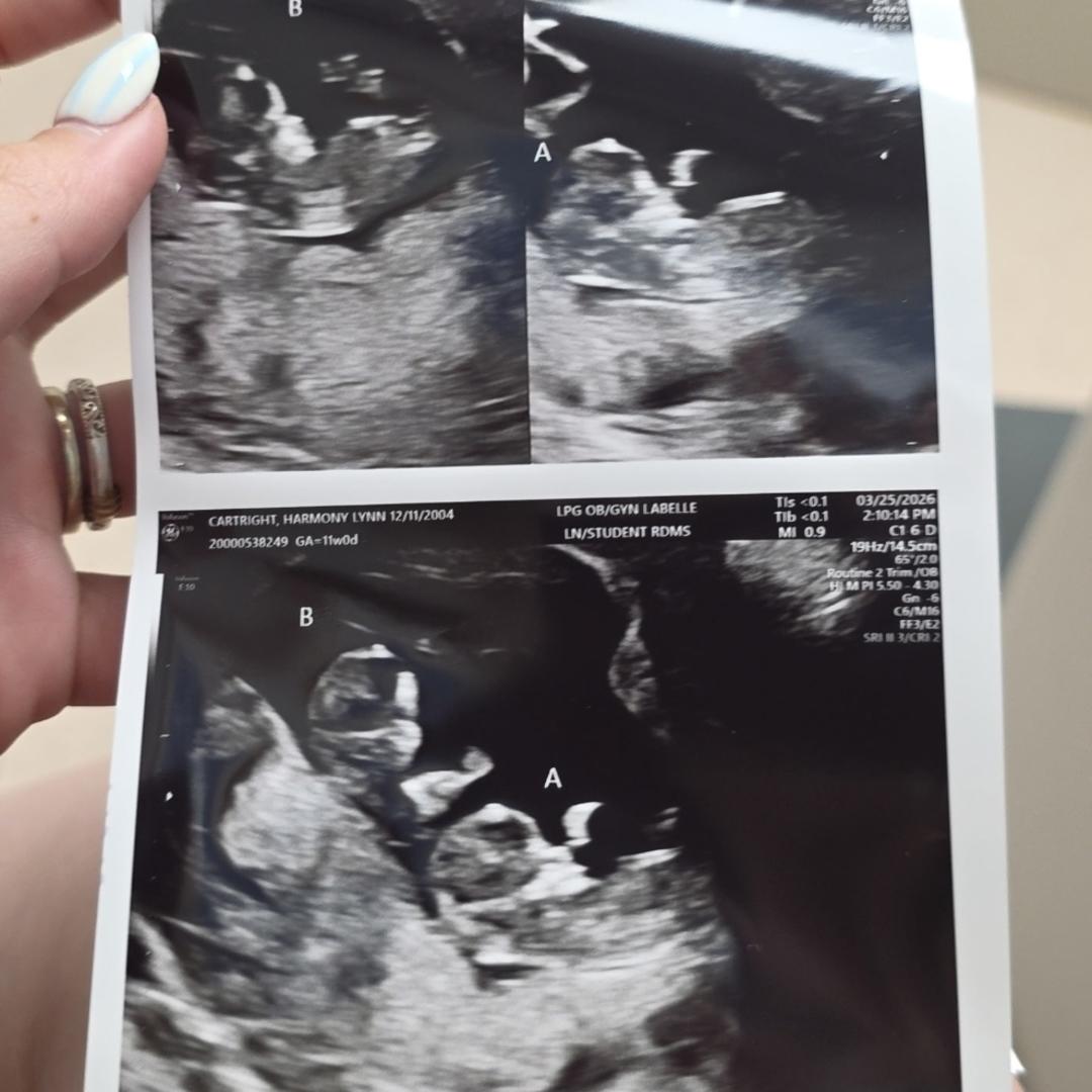 Photo shared by Harmony for their Babylist baby registry.