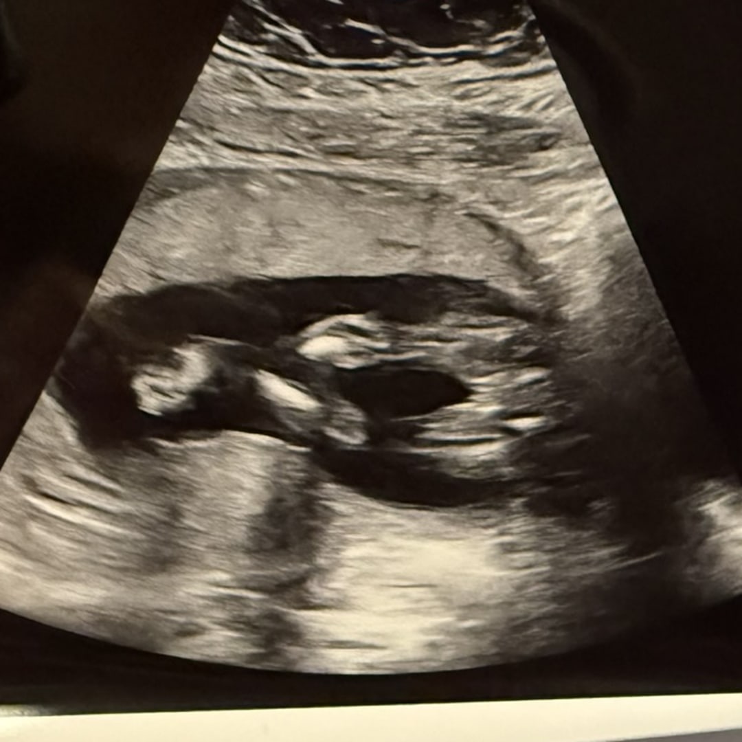Photo shared by Hannah for their Babylist baby registry.