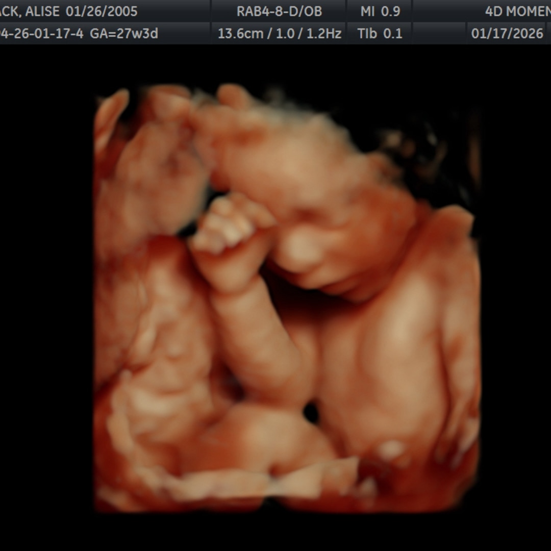 Photo shared by Kole for their Babylist baby registry.