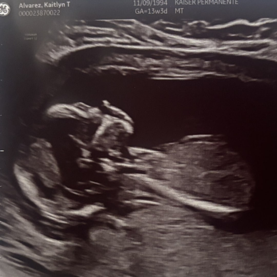 Photo shared by Kaitlyn for their Babylist baby registry.
