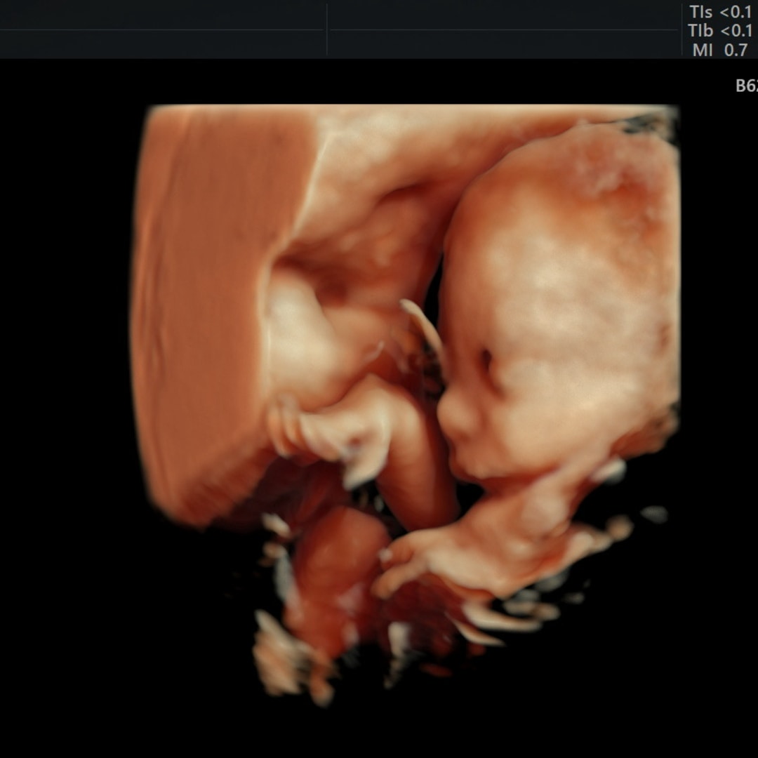 Photo shared by Trinity for their Babylist baby registry.