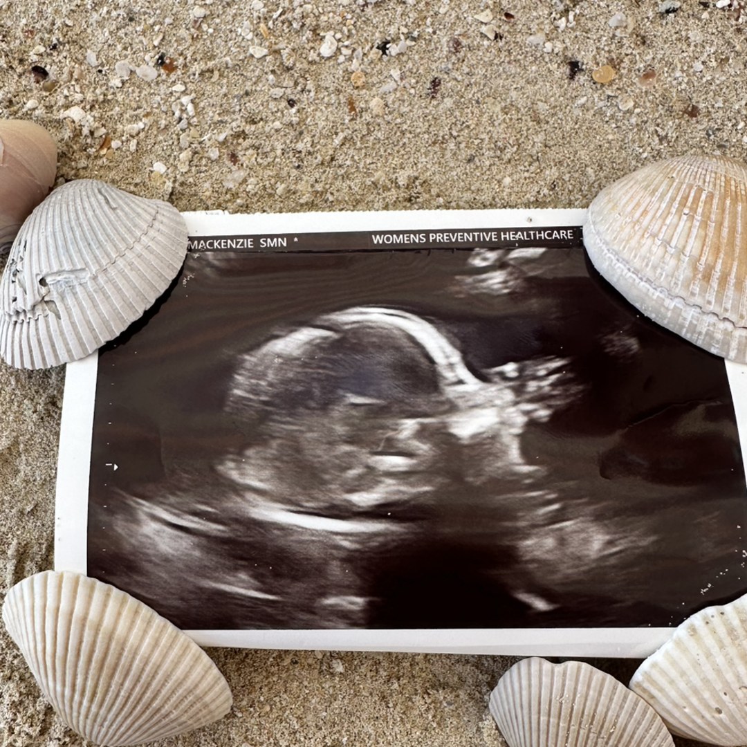Photo shared by Mackenzie for their Babylist baby registry.