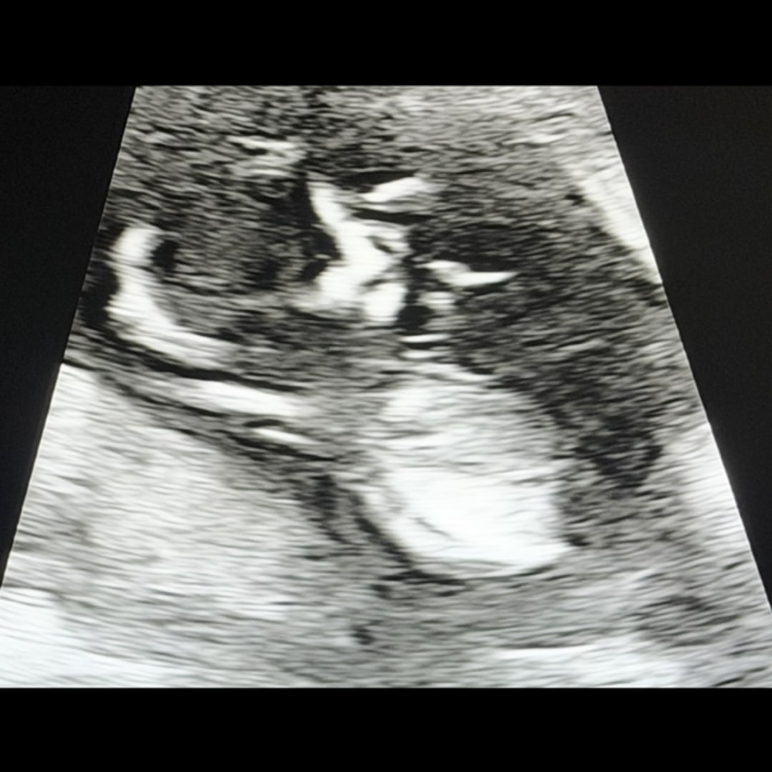 Photo shared by Gabrielle for their Babylist baby registry.