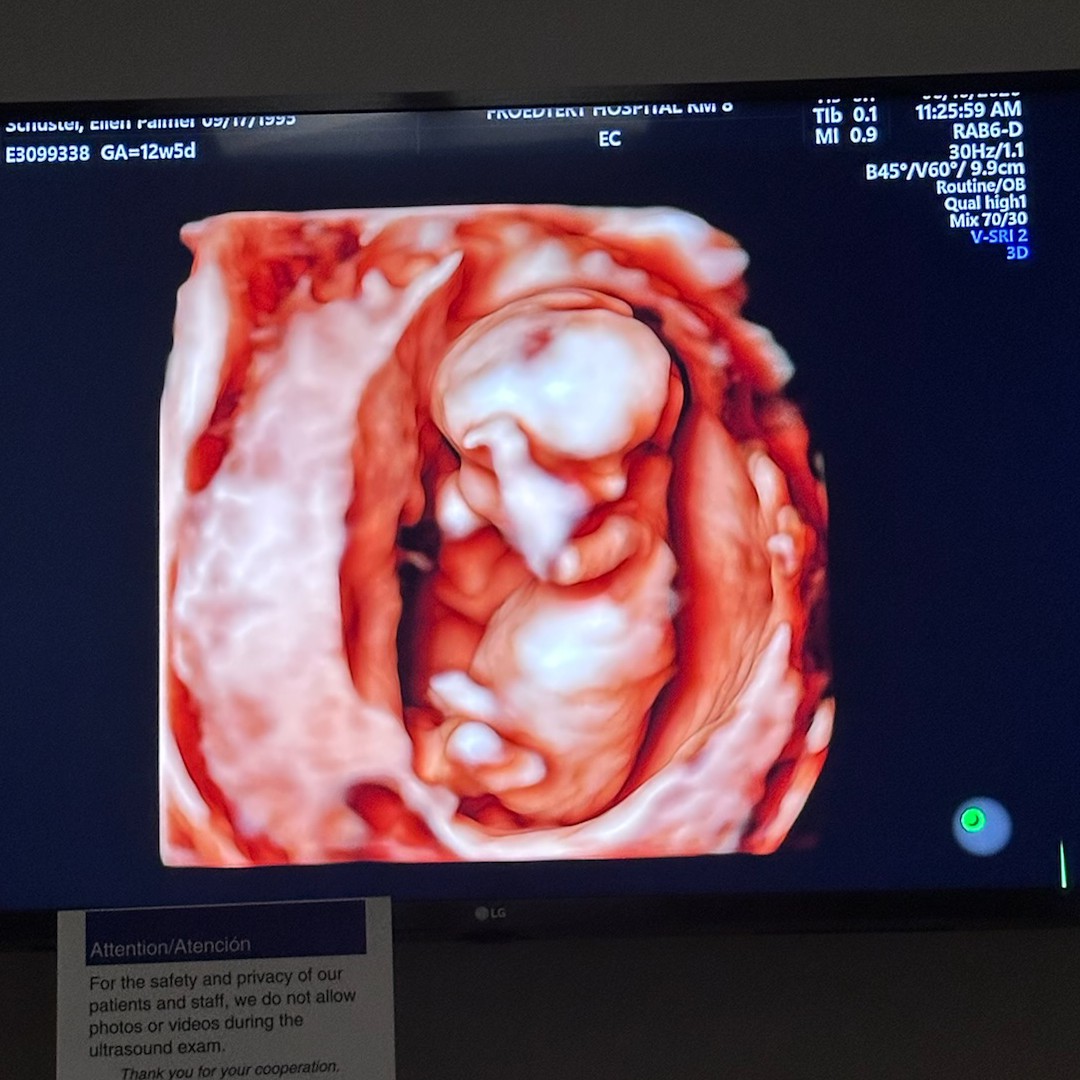 Photo shared by Ellen and Tyler for their Babylist baby registry.