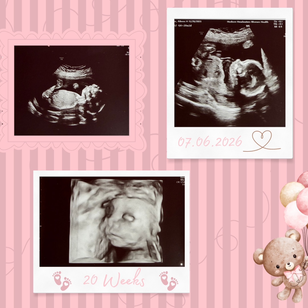 Photo shared by Aileen for their Babylist baby registry.