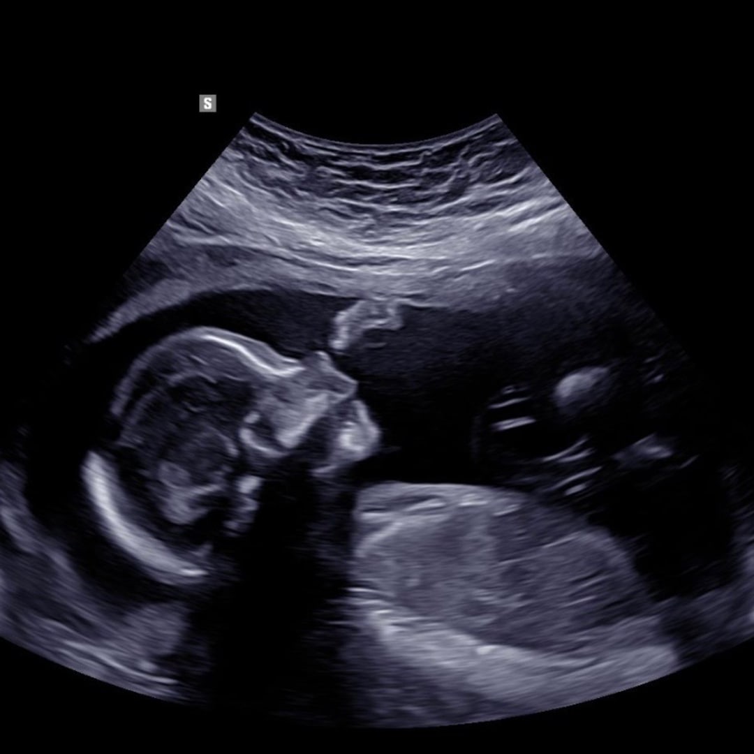 Photo shared by Sara for their Babylist baby registry.