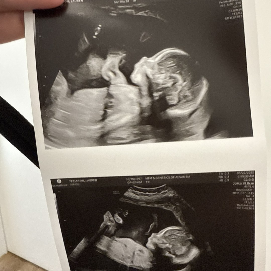 Photo shared by Lauren for their Babylist baby registry.