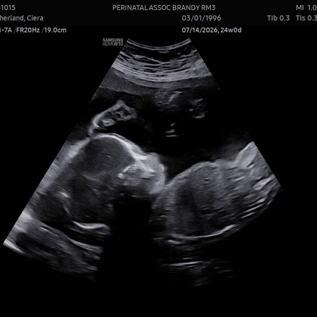 Photo shared by Ciera for their Babylist baby registry.