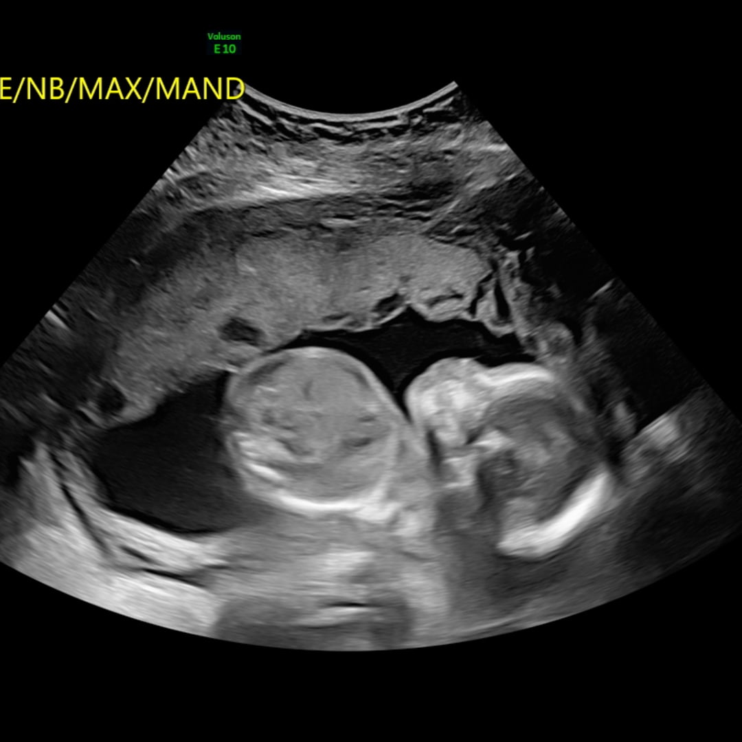Photo shared by Diamonae for their Babylist baby registry.