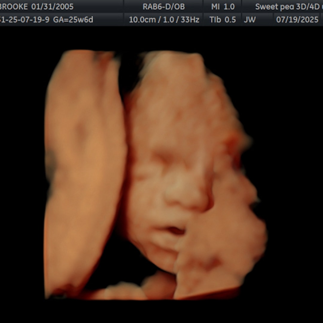 Photo shared by Brooke for their Babylist baby registry.