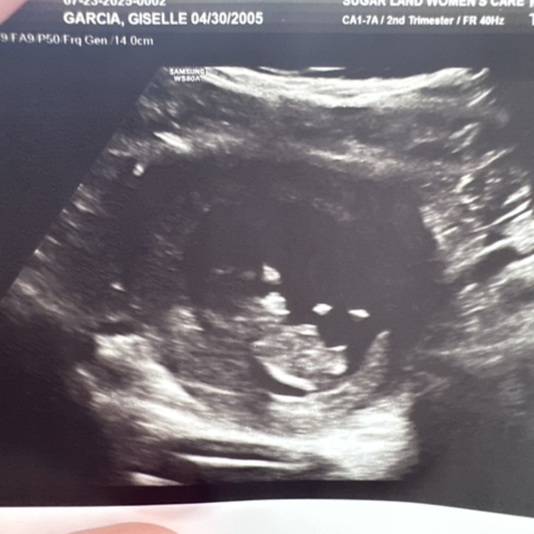 Photo shared by Giselle for their Babylist baby registry.