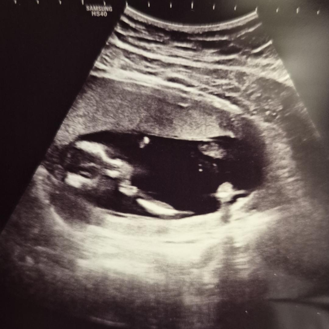 Photo shared by Yosi & Meg for their Babylist baby registry.