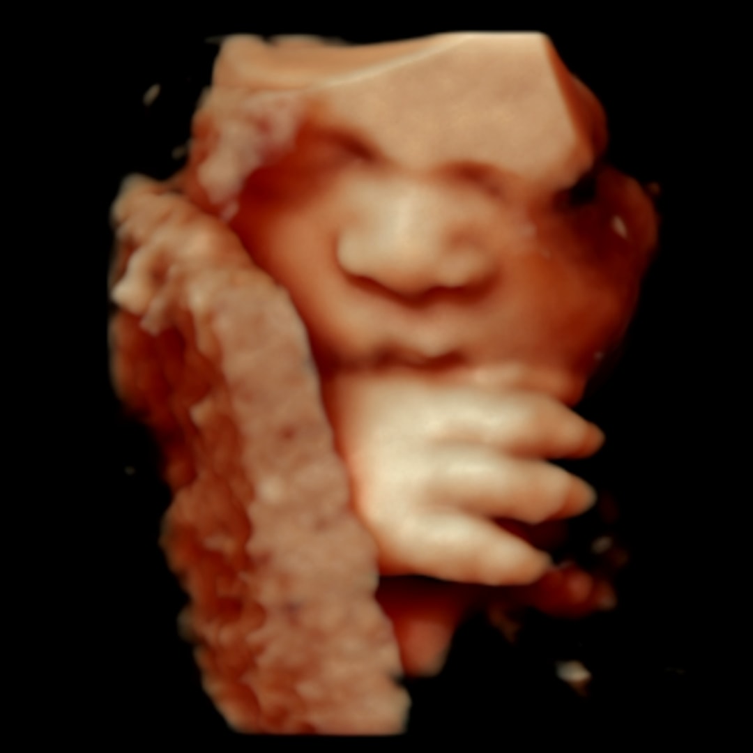 Photo shared by Alyssa for their Babylist baby registry.