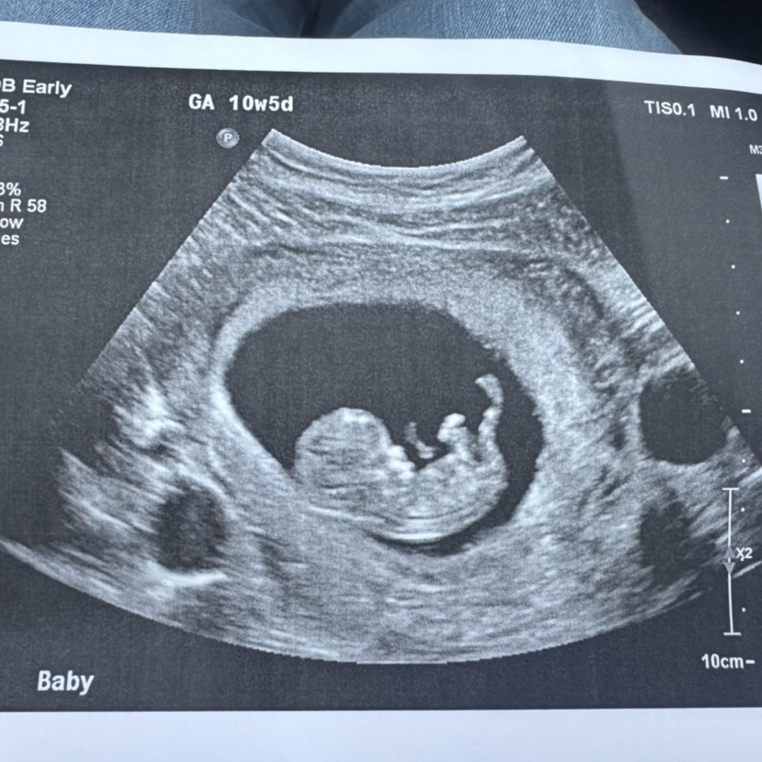 Photo shared by Lindsey for their Babylist baby registry.