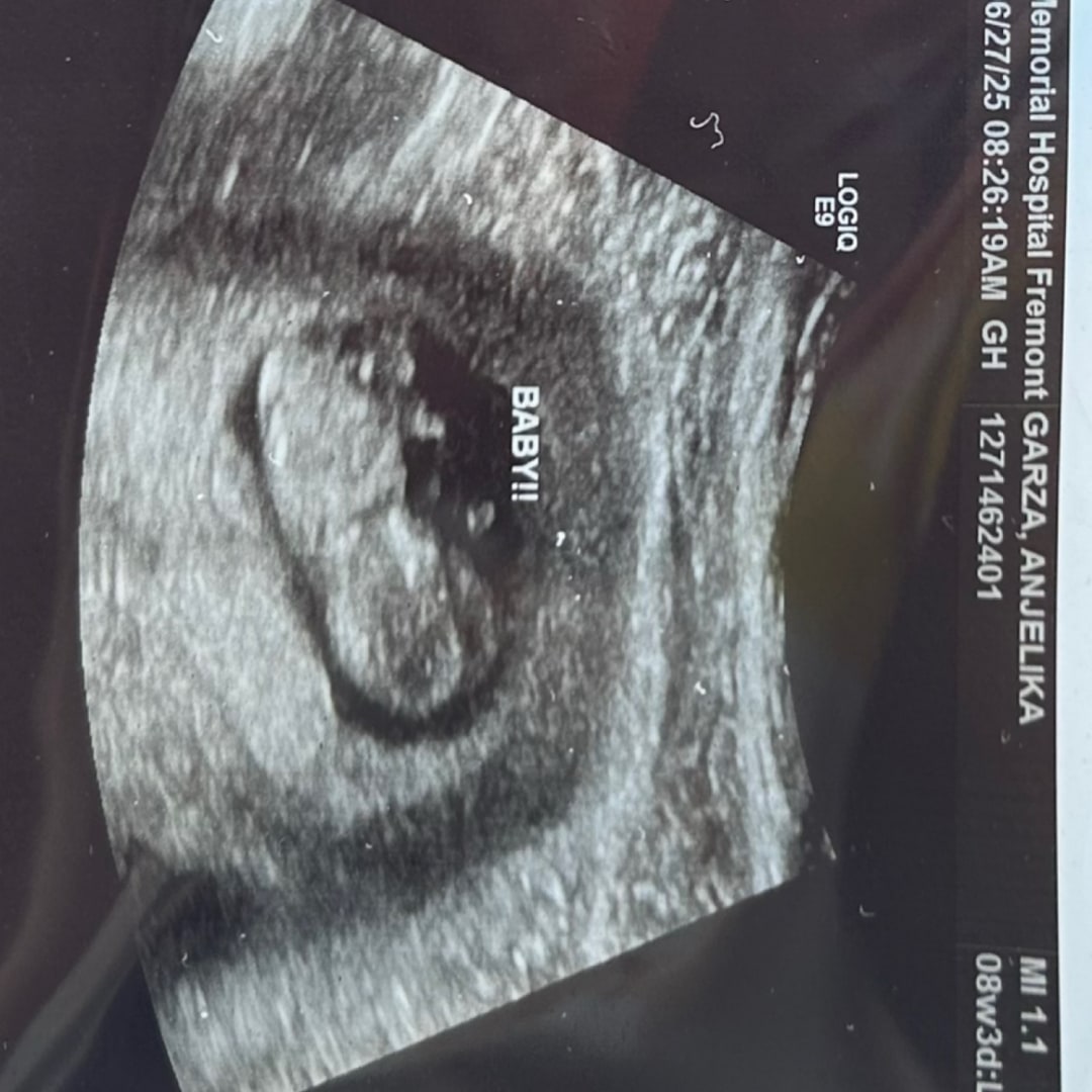 Photo shared by Anjelika for their Babylist baby registry.