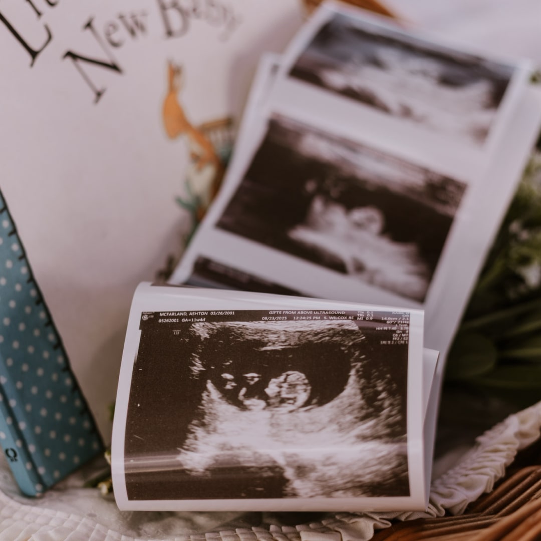 Photo shared by Ashton for their Babylist baby registry.