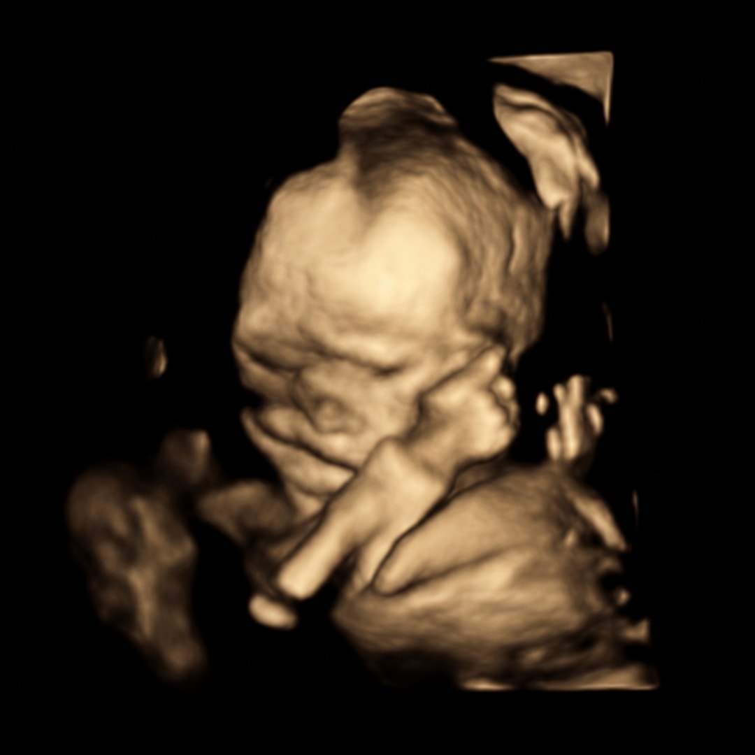 Photo shared by Elizabeth for their Babylist baby registry.