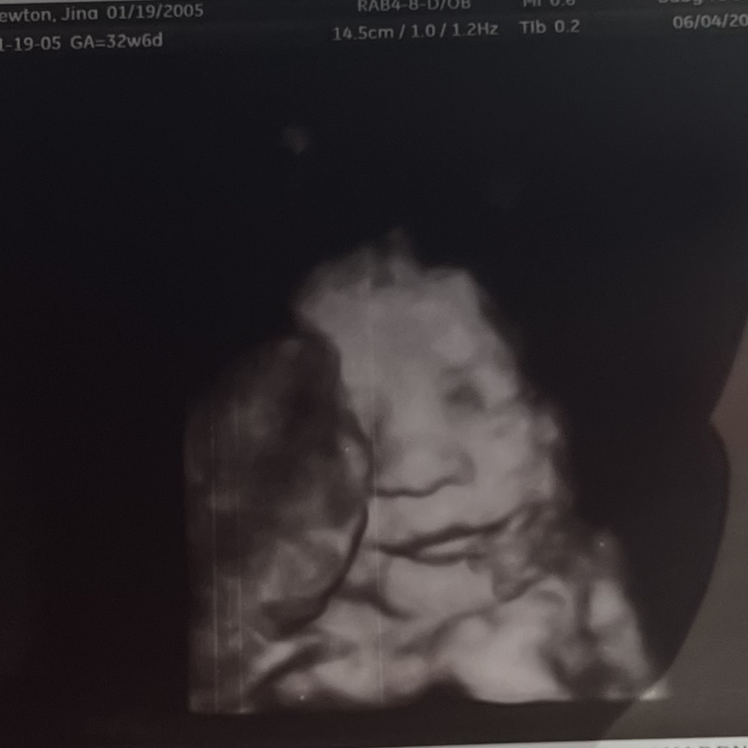 Photo shared by Jina for their Babylist baby registry.