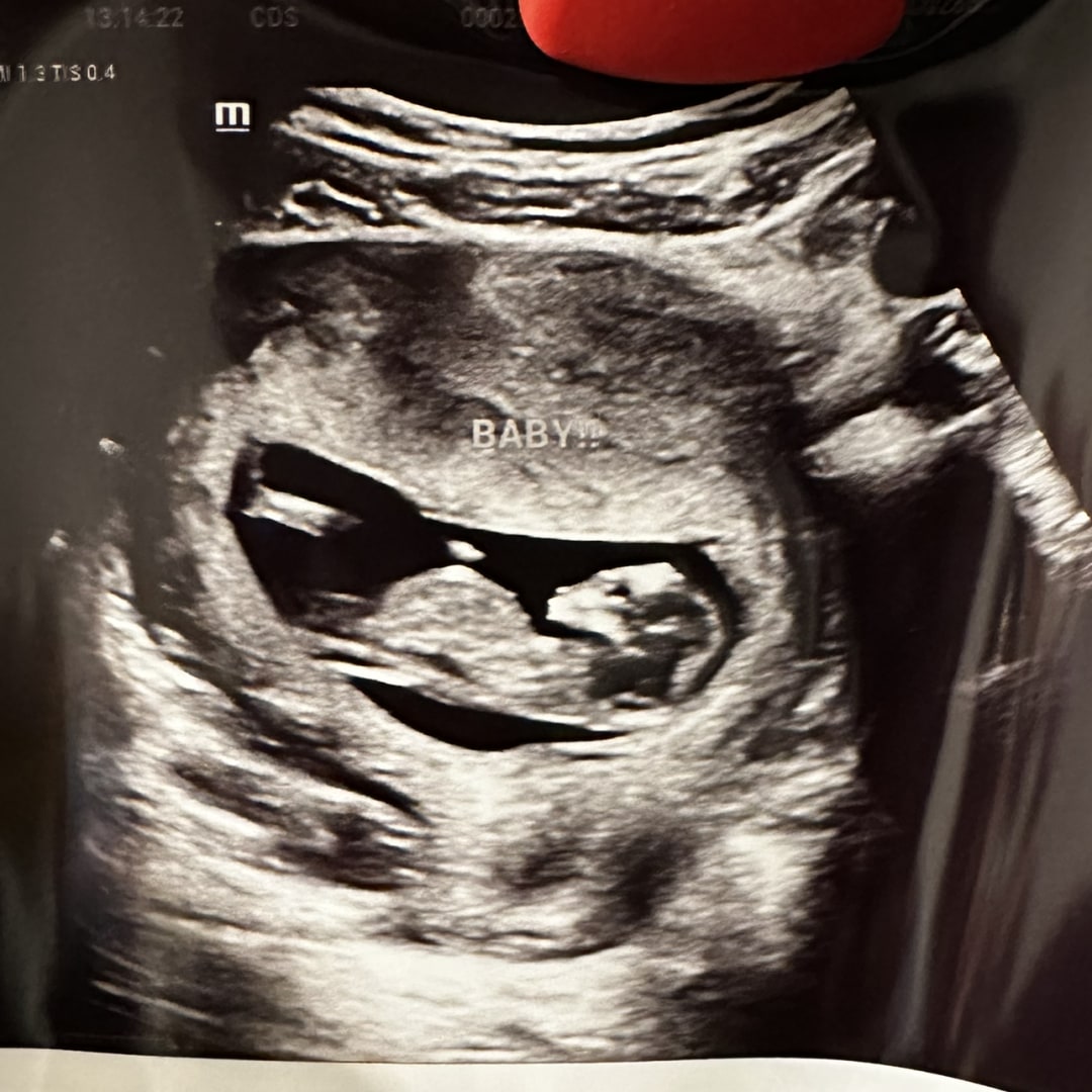 Photo shared by Melissa for their Babylist baby registry.