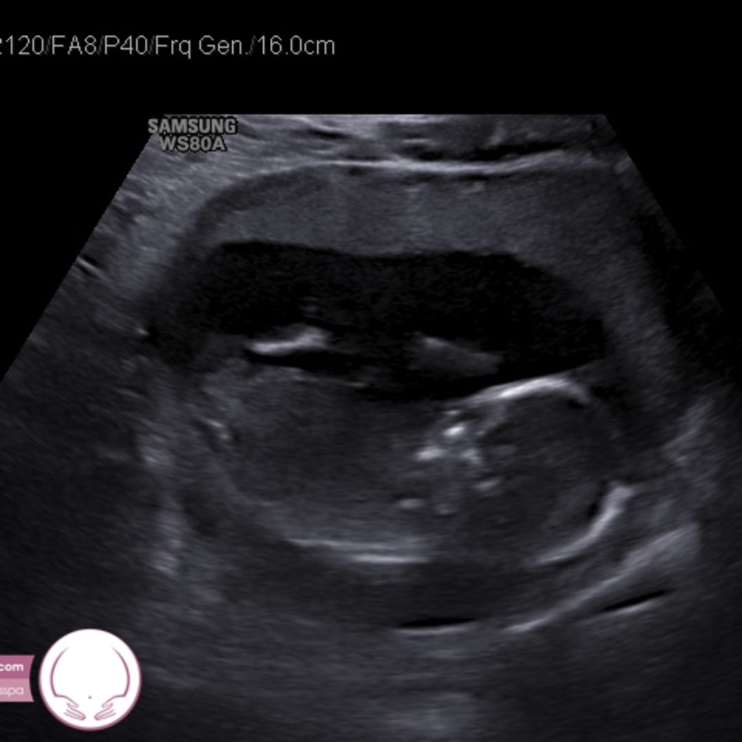 Photo shared by Kelli for their Babylist baby registry.