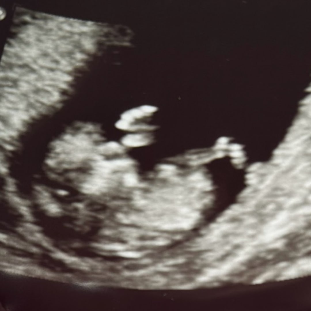 Photo shared by Jasmine for their Babylist baby registry.