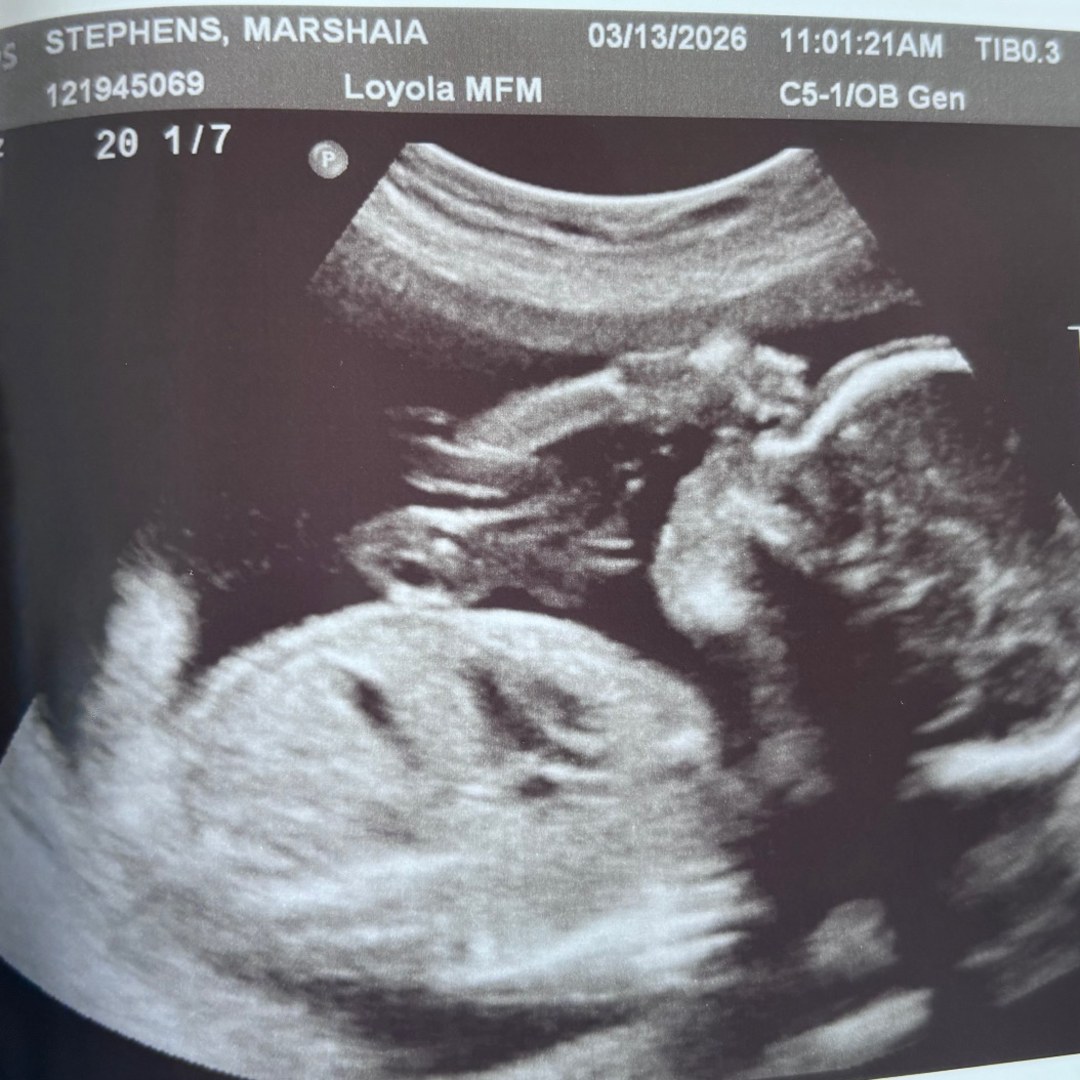 Photo shared by Marshaia for their Babylist baby registry.