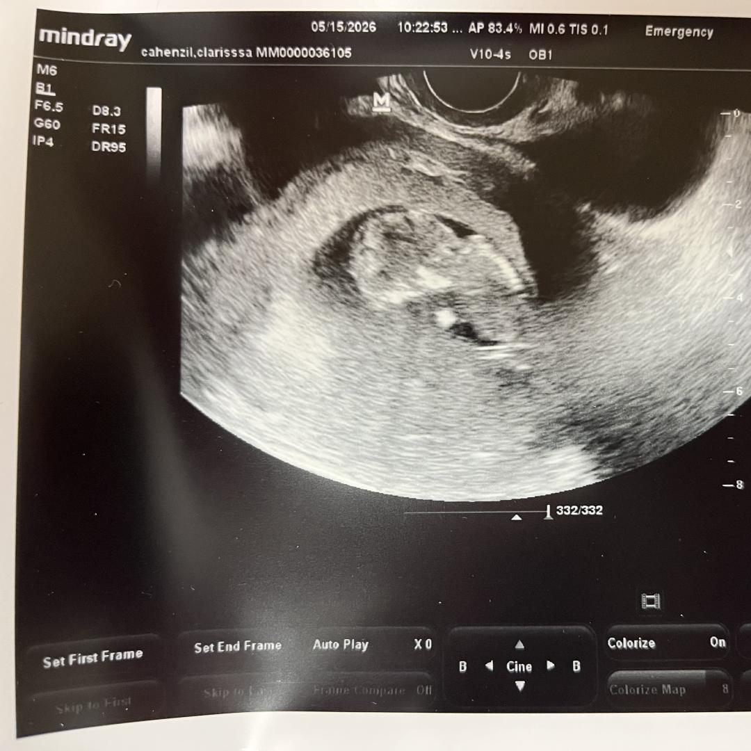 Photo shared by Clarissa for their Babylist baby registry.