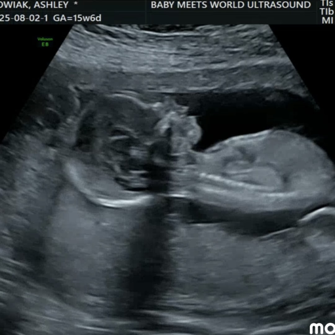 Photo shared by Ashley for their Babylist baby registry.