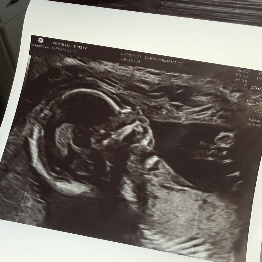 Photo shared by Christy for their Babylist baby registry.