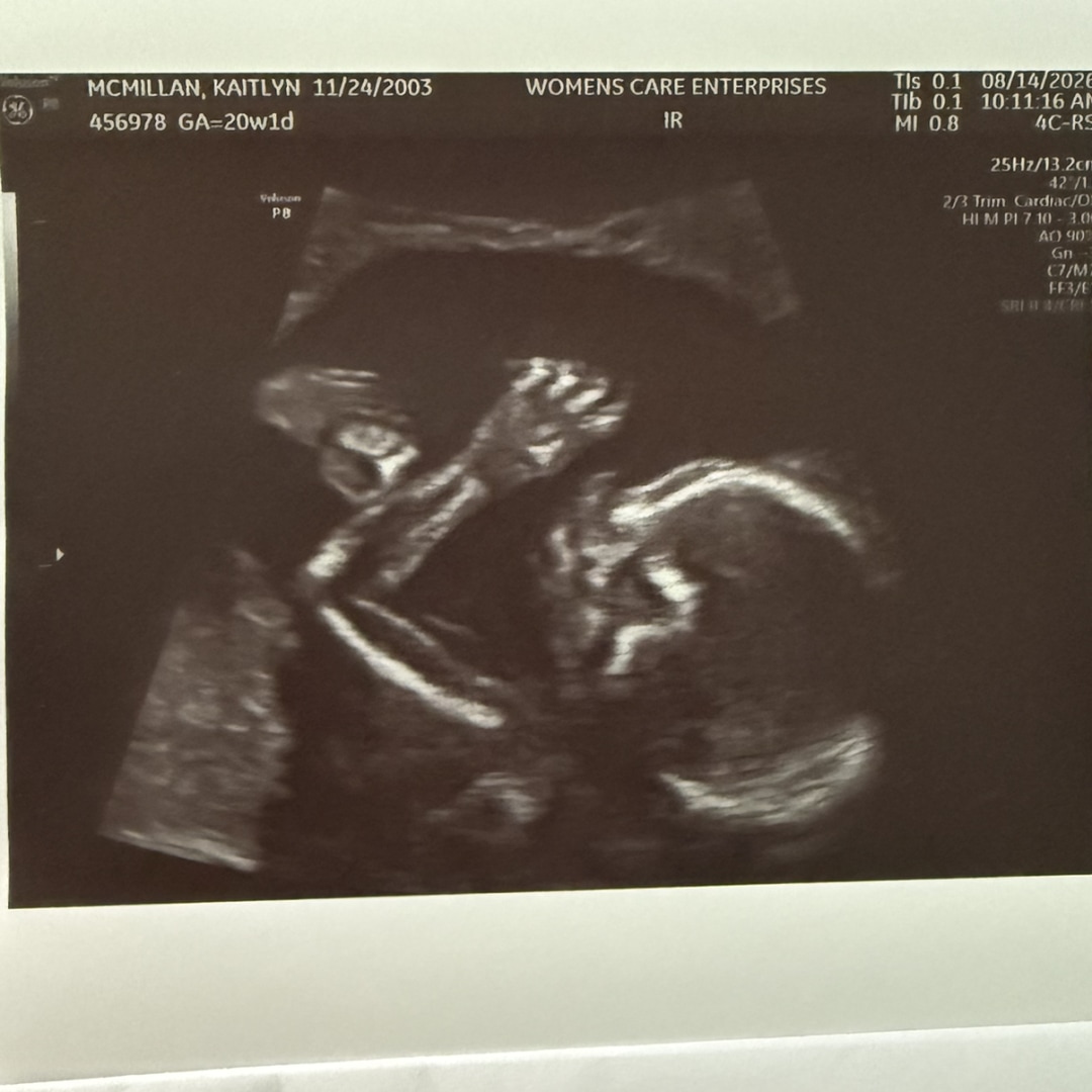 Photo shared by Kaitlyn for their Babylist baby registry.