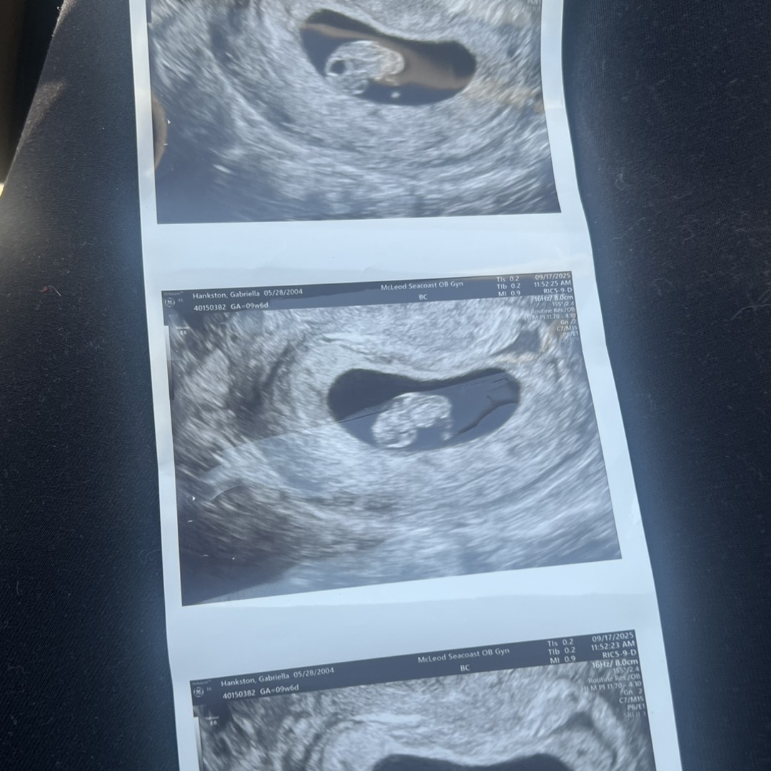 Photo shared by Gabriella for their Babylist baby registry.