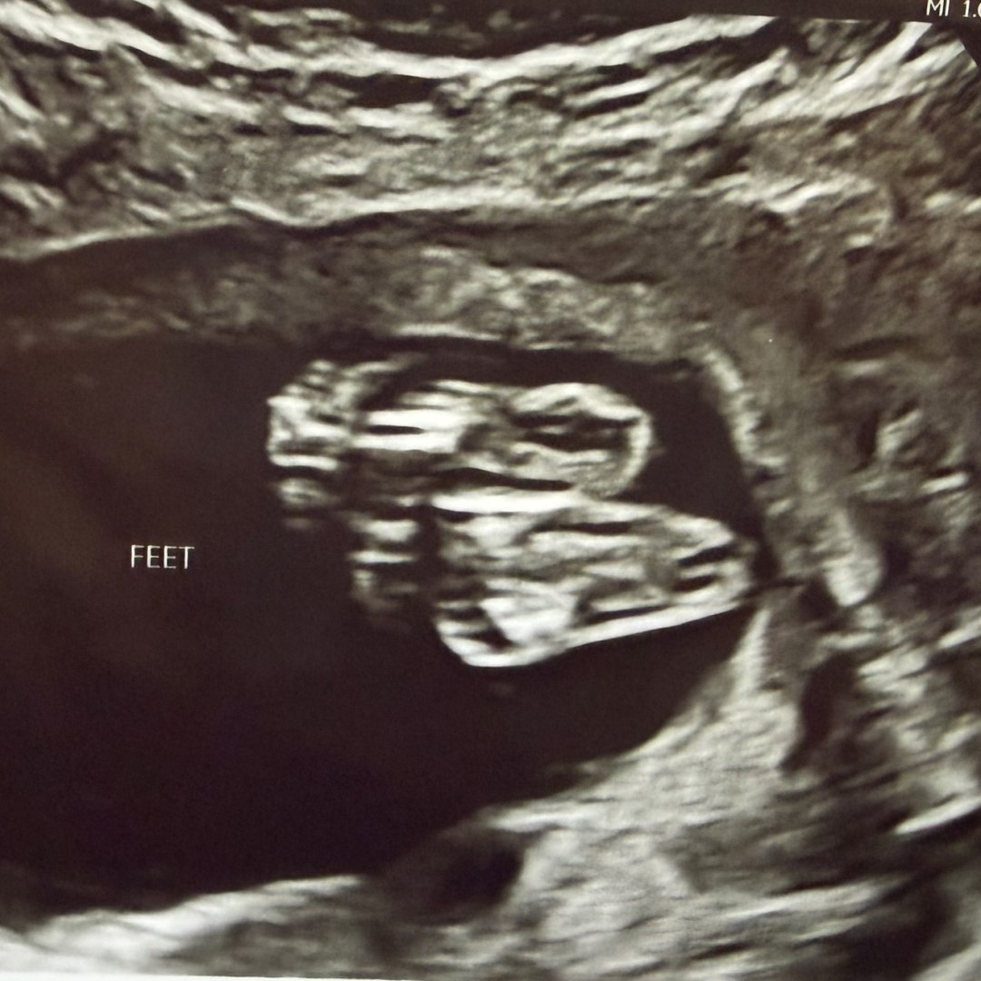 Photo shared by Aubrea for their Babylist baby registry.