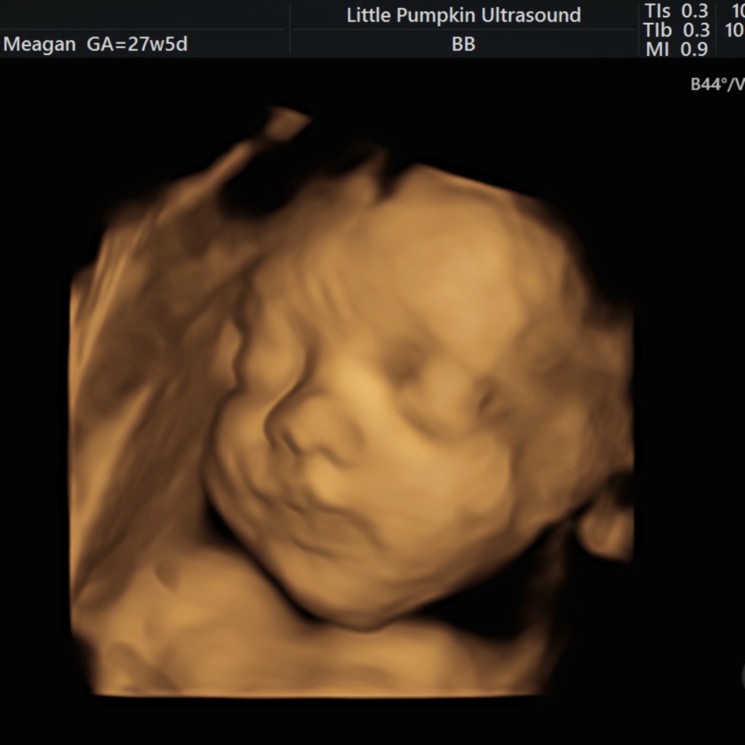 Photo shared by Meagan for their Babylist baby registry.