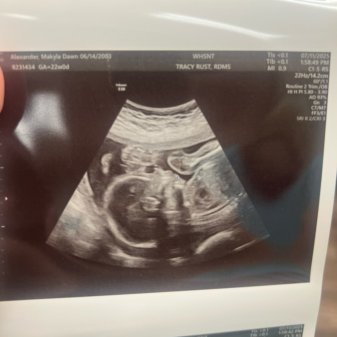 Photo shared by Makyla for their Babylist baby registry.