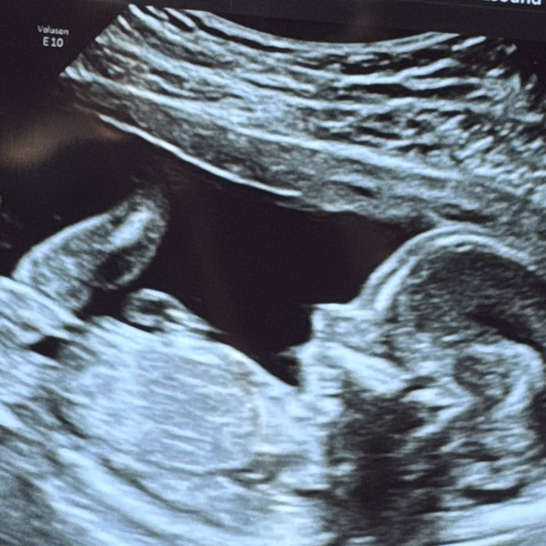 Photo shared by Cheyanne for their Babylist baby registry.