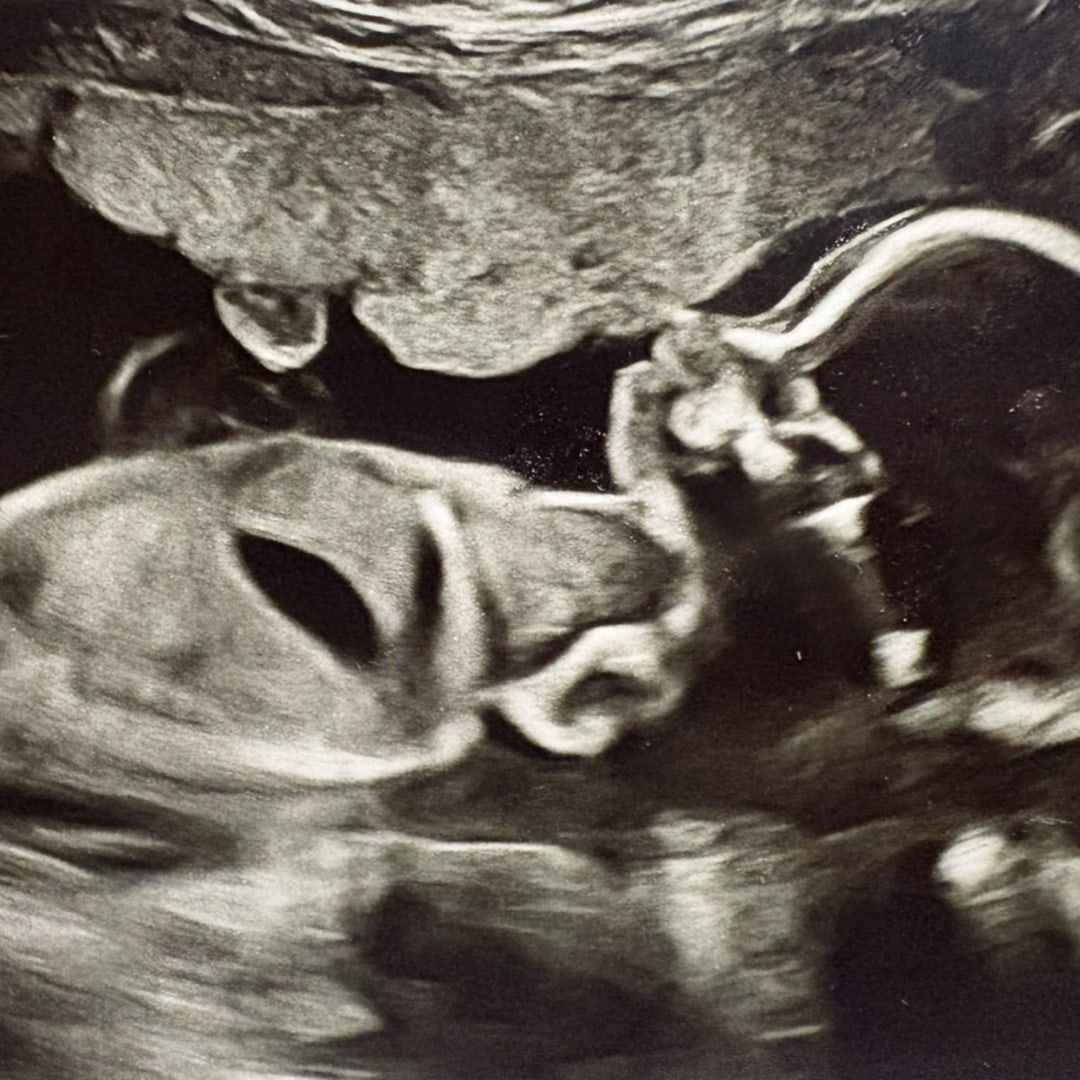 Photo shared by Alina for their Babylist baby registry.